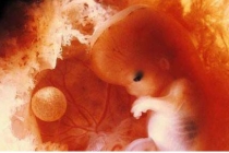 缘分未到孩子自然流产，人生陷入绝境