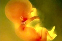 堕胎会影响现在的孩子吗？